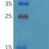 Human CD32a (R167) Protein, hFc Tag