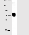 antibody-DME100001 His Fig1