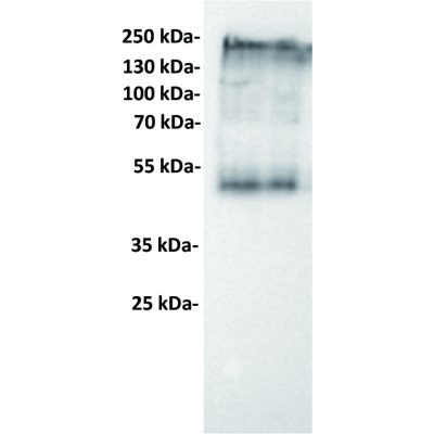 antibody-dmc100120 ceacam5 wb1 1