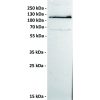 antibody-dmc100228 ror1 wb1 1