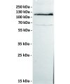 antibody-dmc100228 ror1 wb1 1