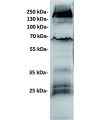 antibody-dmc100508 gucy2c wb1