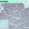 antibody-dmc100832 adam9 ihc1