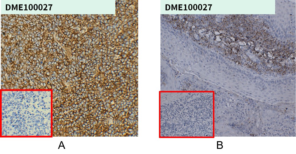 dme100027-cd38-ihc1.jpg