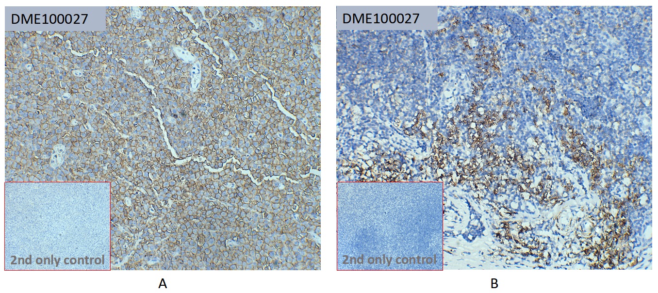 dme100027-cd38-ihc2.jpg