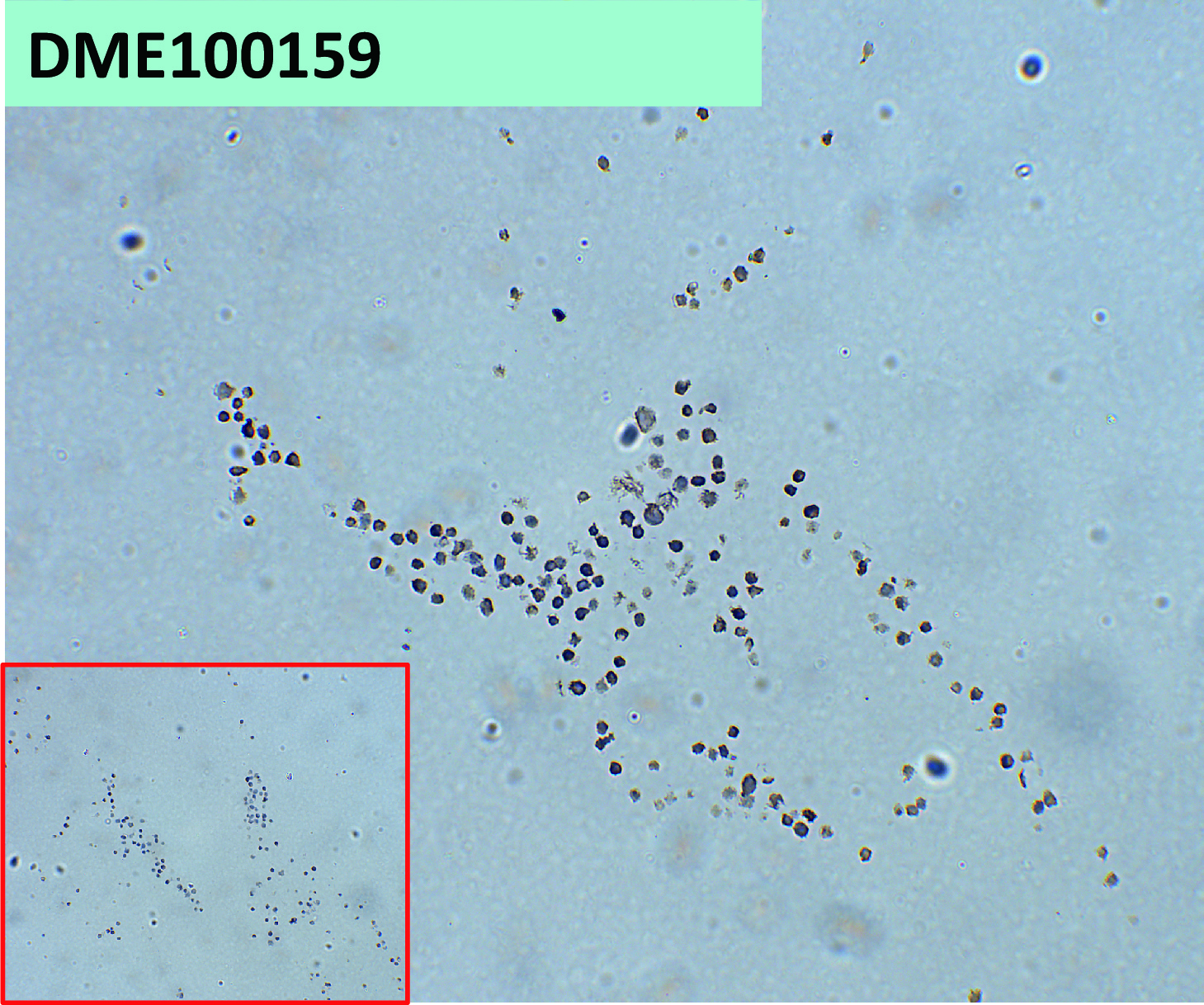 dme100159-ntb-a-ihc1.jpg