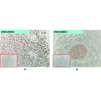 antibody-dme100853 fcrl5 ihc1