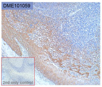 antibody-dme101059 her3 ihc1