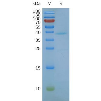 page-FLP100011 GPRC5D Fig.2 SDS PAGE 1