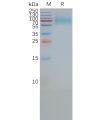 page-FLP100013 SSTR2 Fig.2 SDS PAGE 1