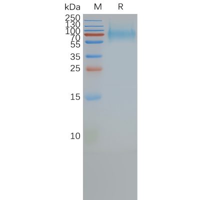 page-FLP100013 SSTR2 Fig.2 SDS PAGE 1