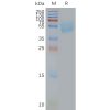 page-FLP100020 ADORA2A Fig.2 SDS PAGE 1