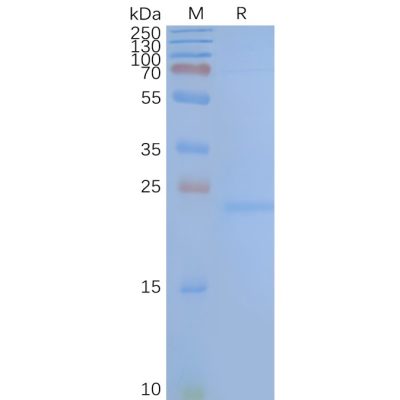 page-FLP100022 TM4SF1 Fig.2 SDS PAGE 1