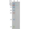 page-FLP100023 CB1 Fig.2 SDS PAGE 1