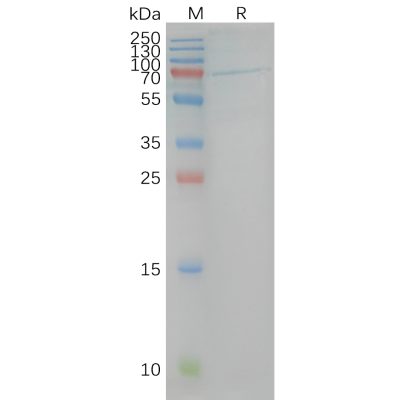 page-FLP100023 CB1 Fig.2 SDS PAGE 1