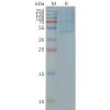 page-FLP100024 CCR4 Fig.2 SDS PAGE 1