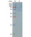 page-FLP100024 CCR4 Fig.2 SDS PAGE 1