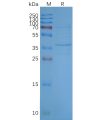 page-FLP100025 OR2H1 Fig.2 SDS PAGE 1