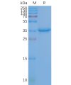 page-FLP100027 CD20 Fig.2 SDS PAGE 1