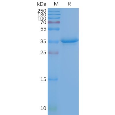 page-FLP100027 CD20 Fig.2 SDS PAGE 1