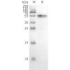 page-FLP100028 CCR2 Fig.3 SDS PAGE 2