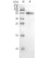 page-FLP100028 CCR2 Fig.3 SDS PAGE 2