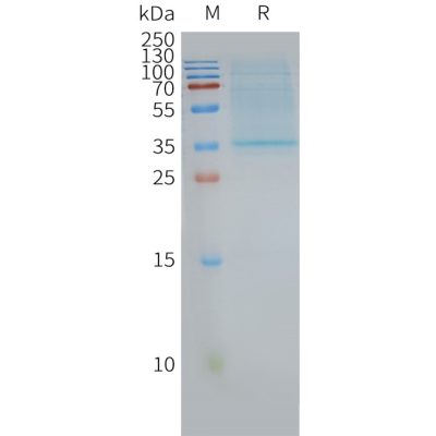 page-FLP100030 CD63 Fig.2 SDS PAGE 1