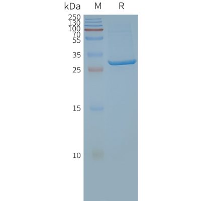 page-FLP100032 SLC25A4 Fig.2 SDS PAGE 1