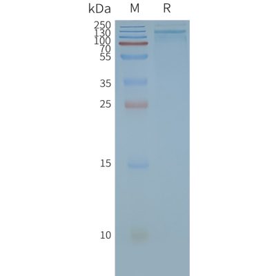 page-FLP100033 TRPA1 Fig.2 SDS PAGE 1