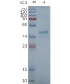 page-FLP100040 STING1 Fig.2 SDS PAGE 1