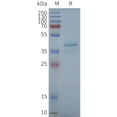 page-FLP100040 STING1 Fig.2 SDS PAGE 1