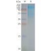 page-FLP100042 CD37 Fig.2 SDS PAGE 1