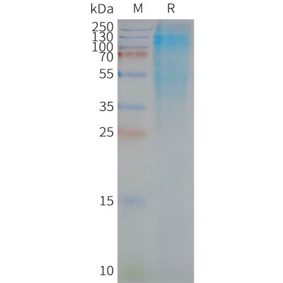 page-FLP100042 CD37 Fig.2 SDS PAGE 1