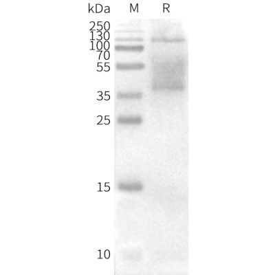 page-FLP100042 CD37 Fig.3 SDS PAGE 2