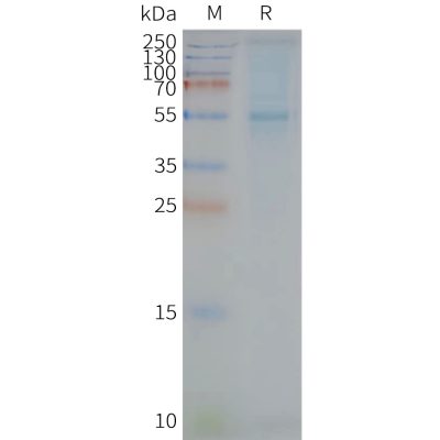 page-FLP100043 STEAP2 Fig.2 SDS PAGE 1