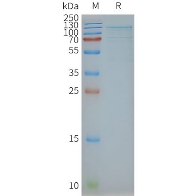 page-FLP100045 TSHR Fig.2 SDS PAGE 1