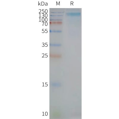 page-FLP100046 PROM1 Fig.2 SDS PAGE 1