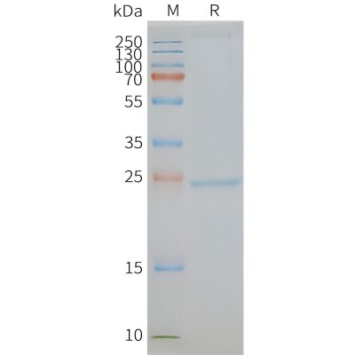 page-FLP100050 CD81 Fig.2 SDS PAGE 1