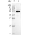 page-FLP100053 CXCR3 Fig.2 SDS PAGE 1