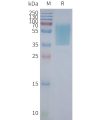 page-FLP100054 GPR55 Fig.2 SDS PAGE 1