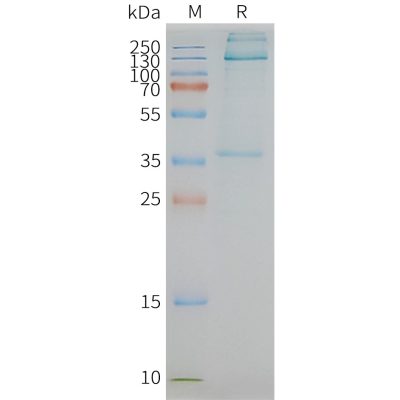 page-FLP100055 ADGRE1 Fig.2 SDS PAGE 1