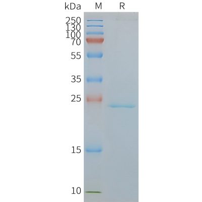 page-FLP100058 CMTM6 Fig.2 SDS PAGE 1