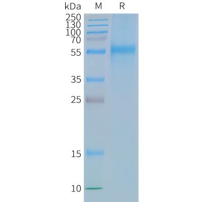 page-FLP100061 CCR9 Fig.2 SDS PAGE 1