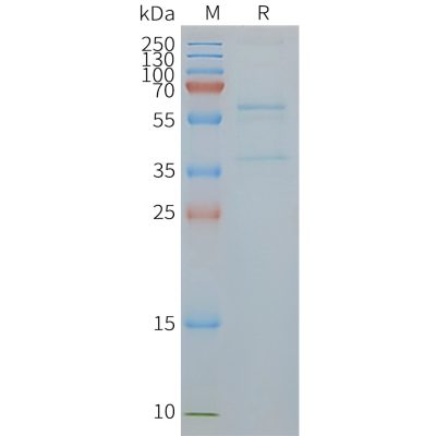 page-FLP100064 SLC2A4 Fig.2 SDS PAGE 1