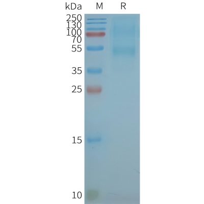 page-FLP100067 CXCR5 Fig.2 SDS PAGE 1