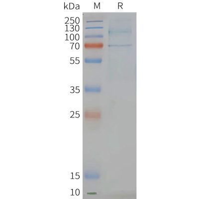 page-FLP100068 LGR6 Fig.2 SDS PAGE 1