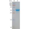 page-FLP100070 STEAP1 Fig.2 SDS PAGE 1