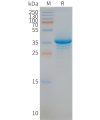 page-FLP100070 STEAP1 Fig.2 SDS PAGE 1