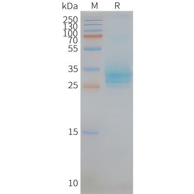 page-FLP100071 CD151 Fig.2 SDS PAGE 1