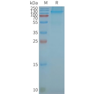 page-FLP100073 LGR5 Fig.2 SDS PAGE 1